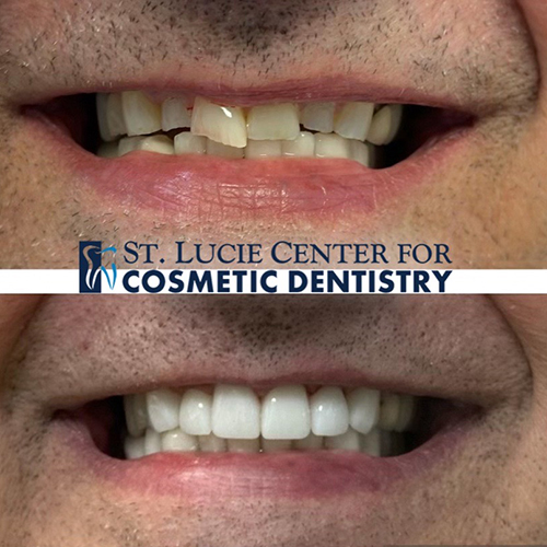 Aesthetic Dentistry: Transforming Smiles, Boosting Confidence - St ...