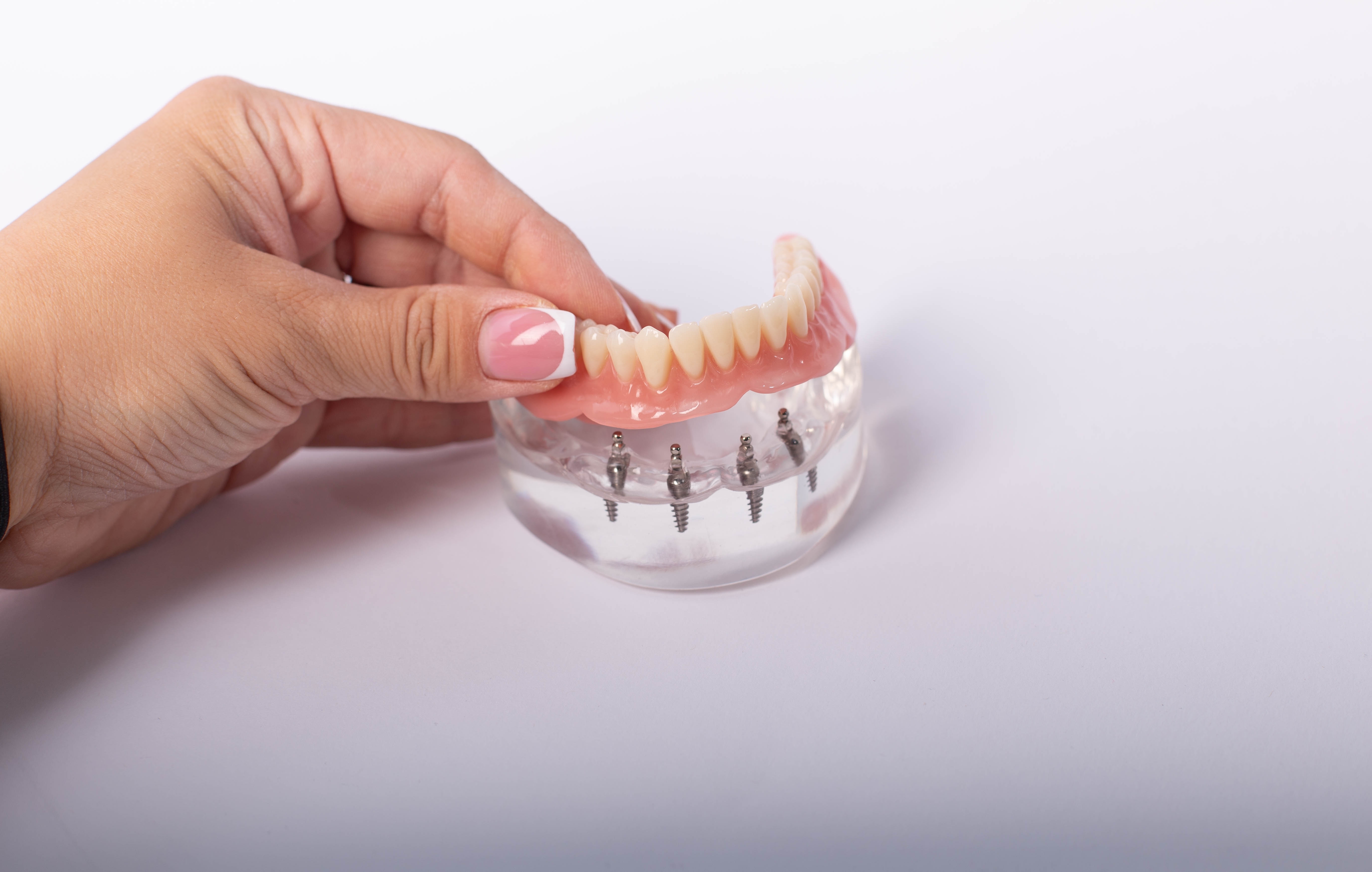 Denture Implants In Port St  Lucie, FL