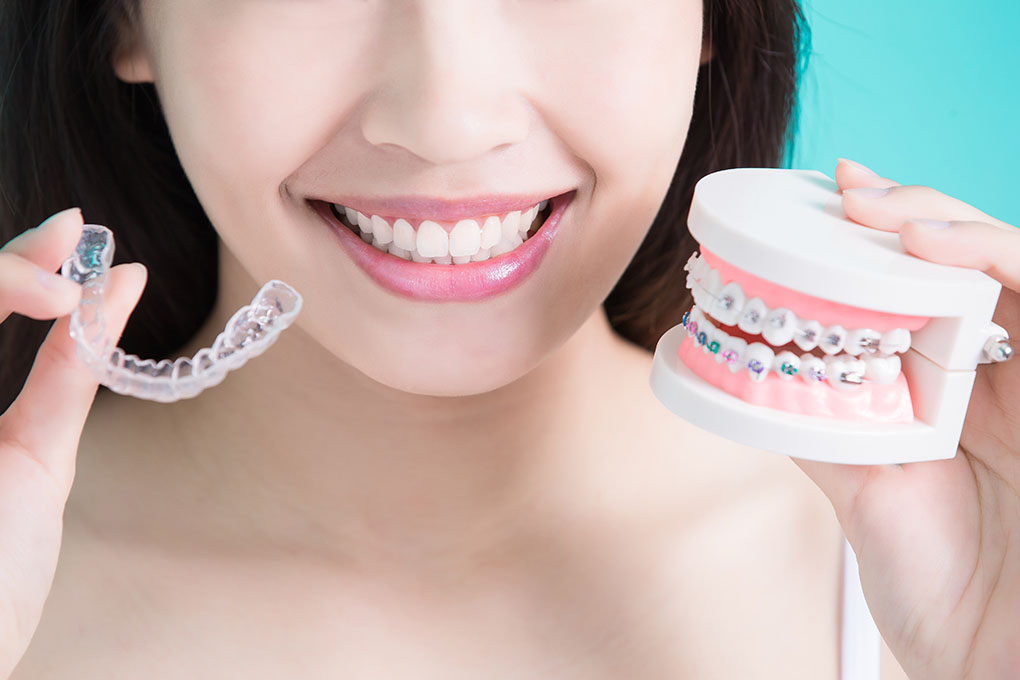 invisalign vs braces